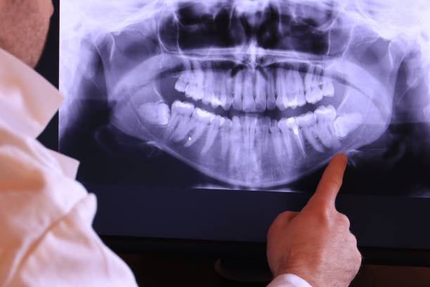 Best Emergency Treatment for Oral Infections in Fairchance, PA